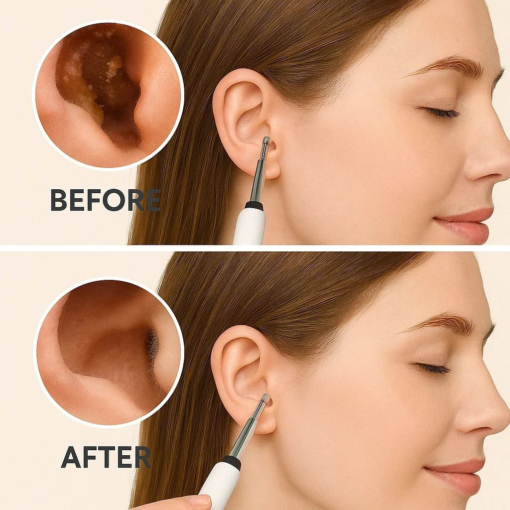 Ear Cleaner Pro – 1080P HD Camera